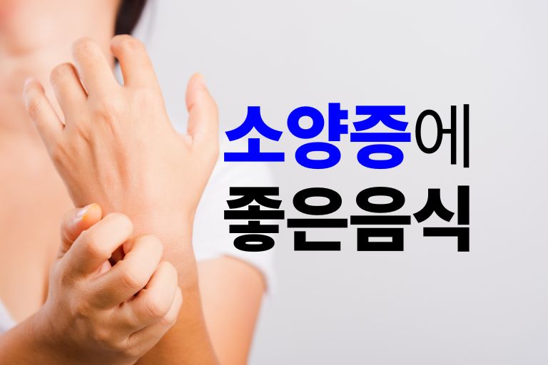 가려움증 완화 소양증에 좋은 음식 7가지